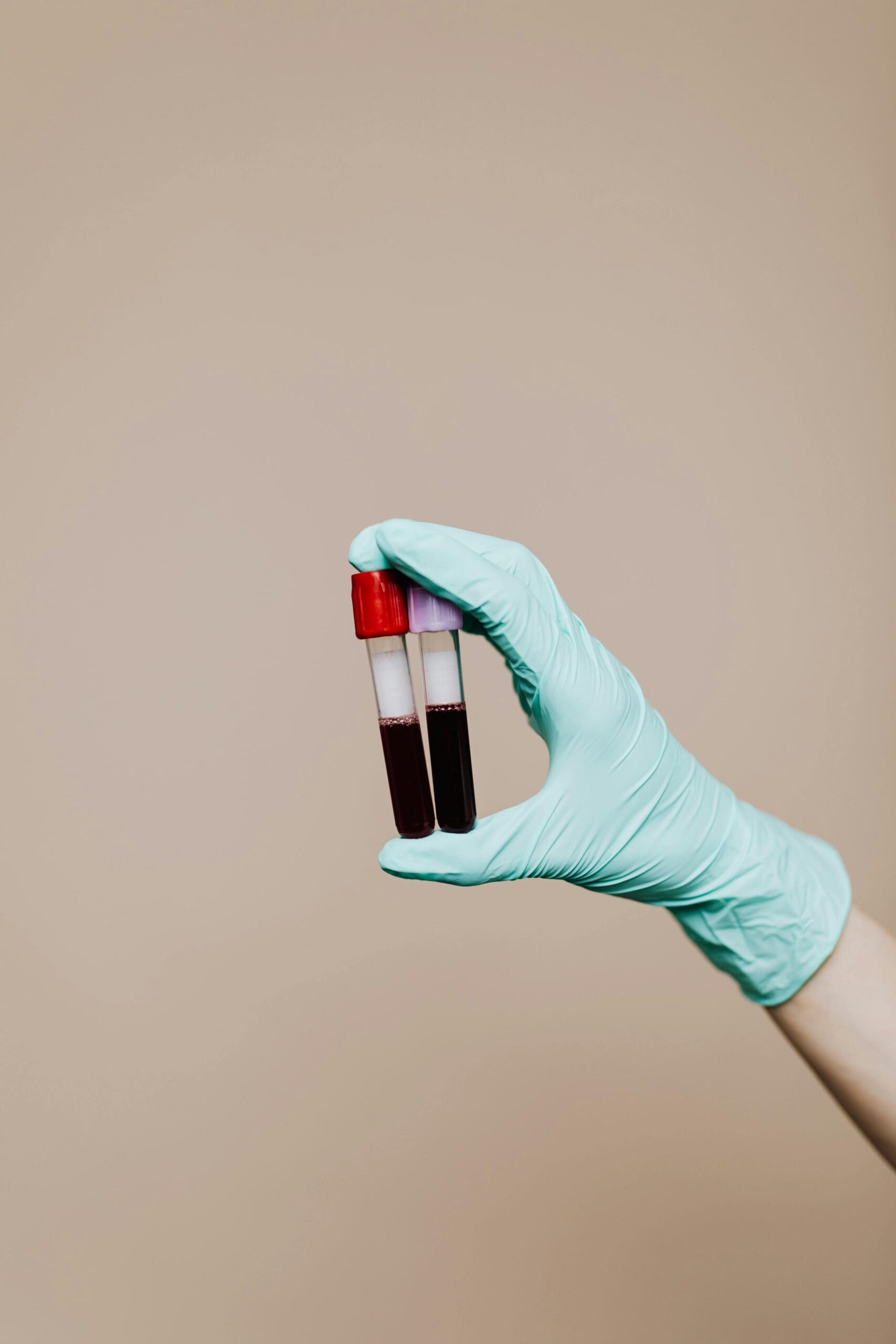 A gloved hand holding two vials of blood.